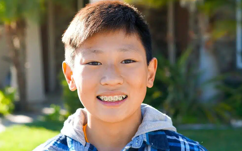 A boy with braces.