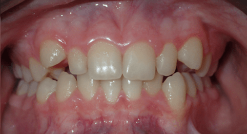Left Image