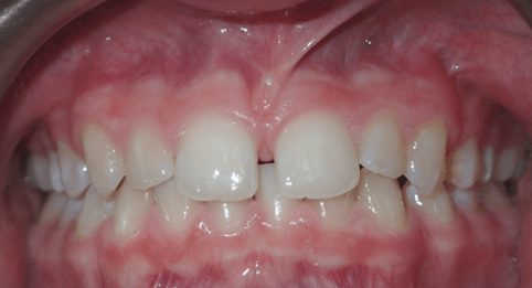 Left Image