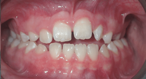 Left Image