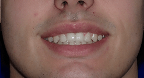 Right Image