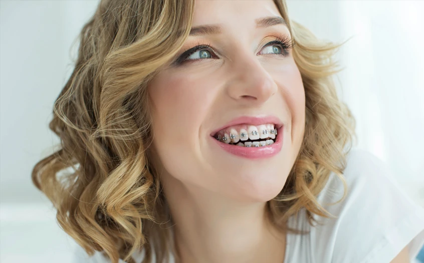 Orthodontics for Adults