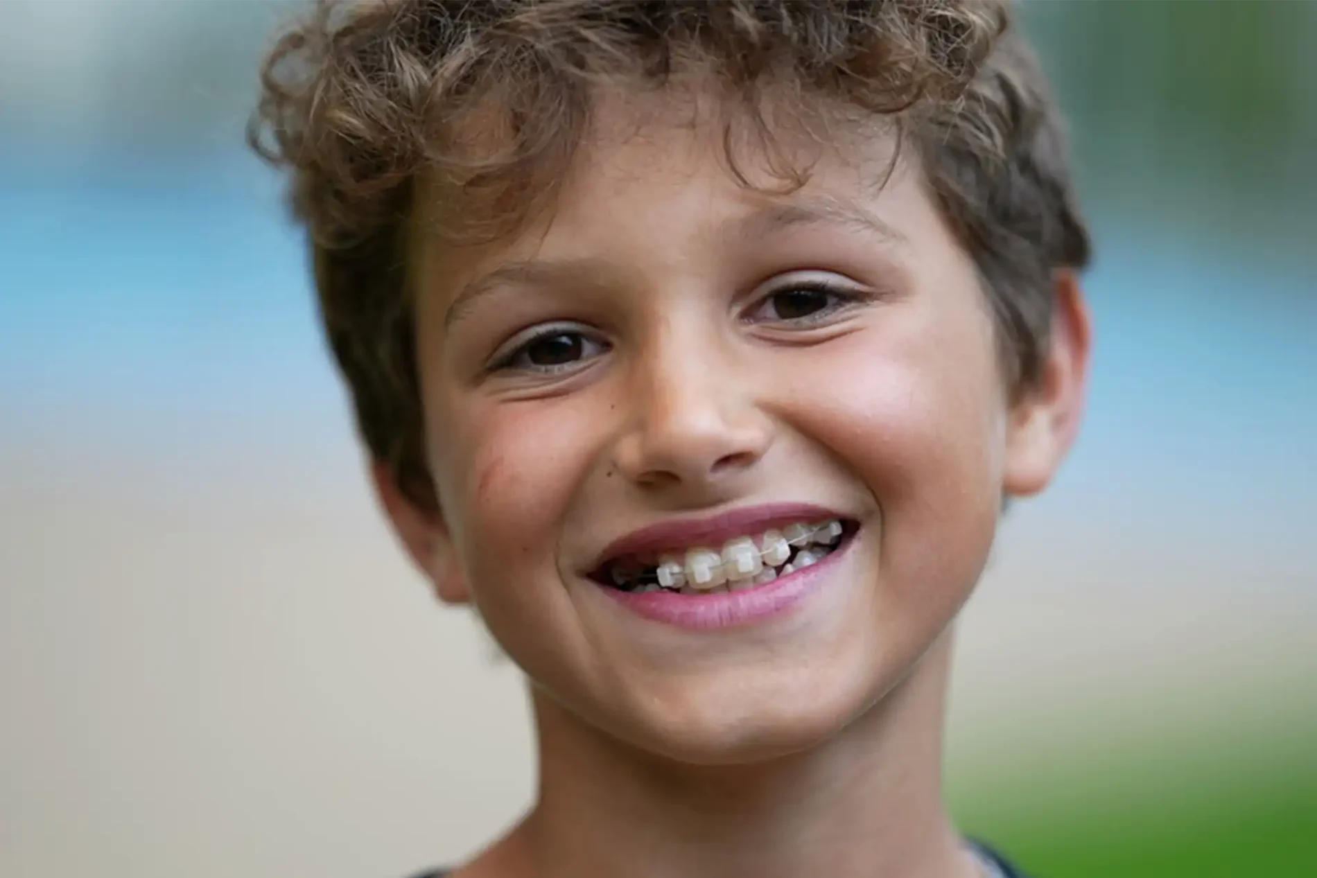 What Are Early Signs Your Child Needs Braces?