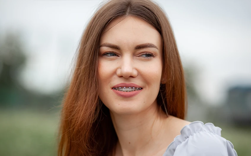 Traditional Metal Braces